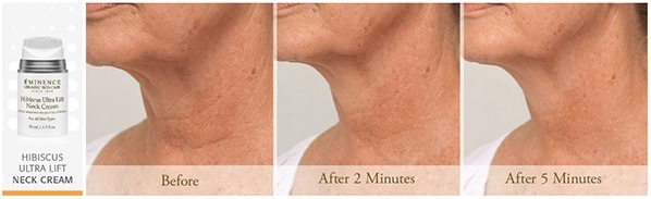 acu neckcream reized NEW: Age Corrective Ultra - Visible Results In 2 Minutes Eminence Organic Skincare