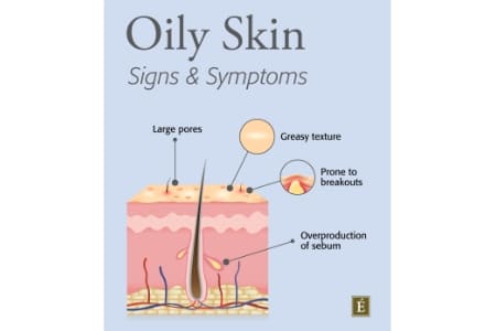 Oily Skin Signs and Symptons 001